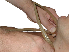 NorMors Kinnstütze 10 Stück - 0